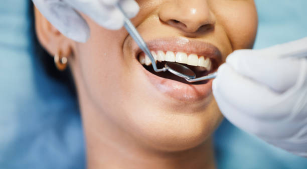 Best Emergency Treatment for Dental Infections or Abscesses in Santa Fe, TX