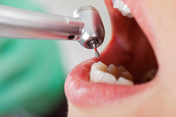 Best After-Hours Dental Trauma Care in Santa Fe, TX